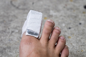 What To Do If You Have Broken Your Toe